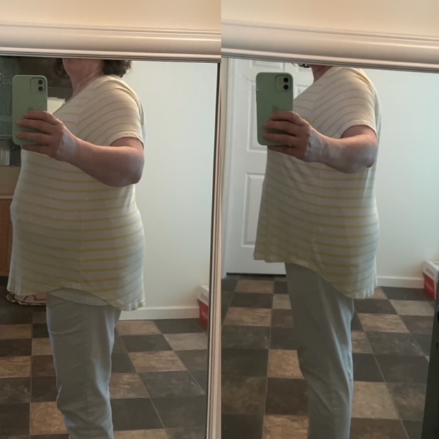 Patient down 12 lbs — 7 weeks