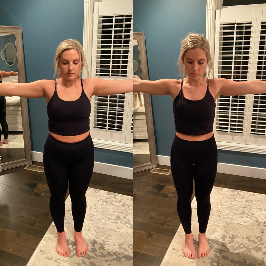 Patient down 32 lbs — Sustained